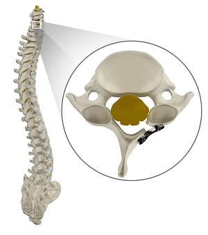 Disc Decompression