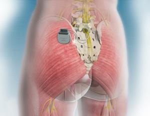 Neuromodulation