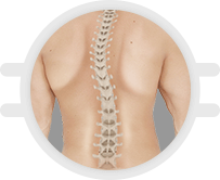 Spinal Deformities